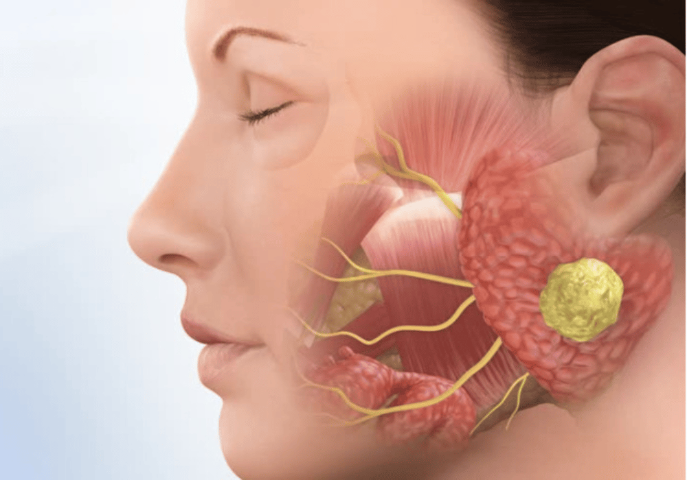 Facial Bone Fractures (9)