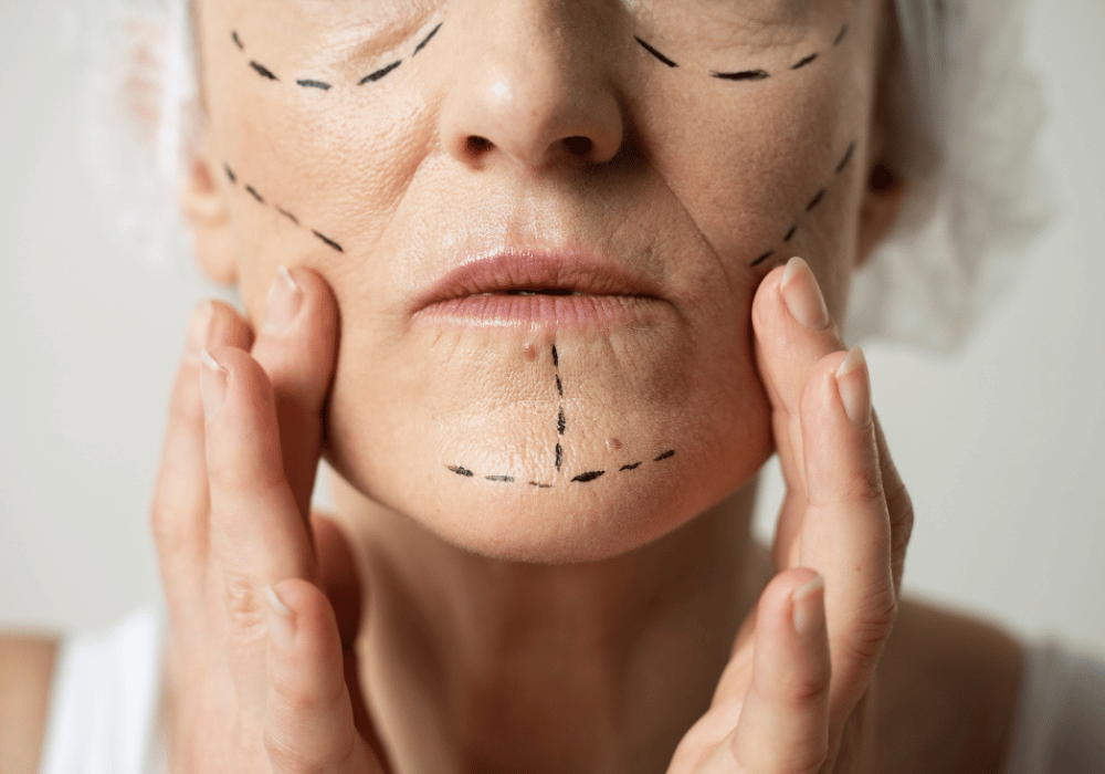 Post trauma facial deformities